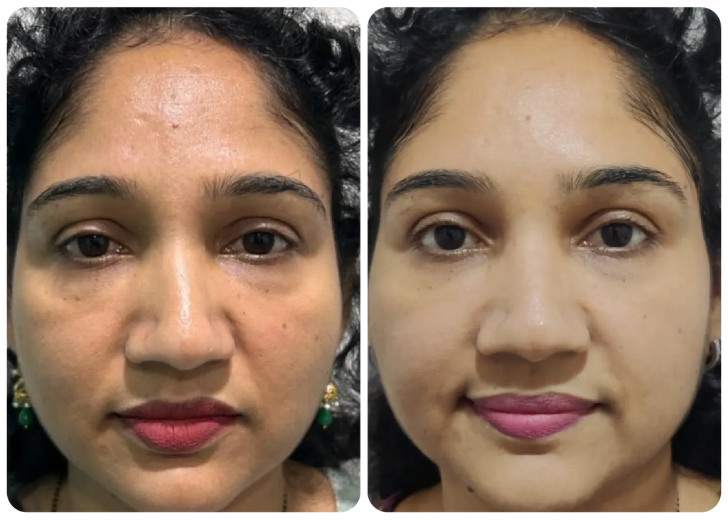1 RS WHITENING CREAM