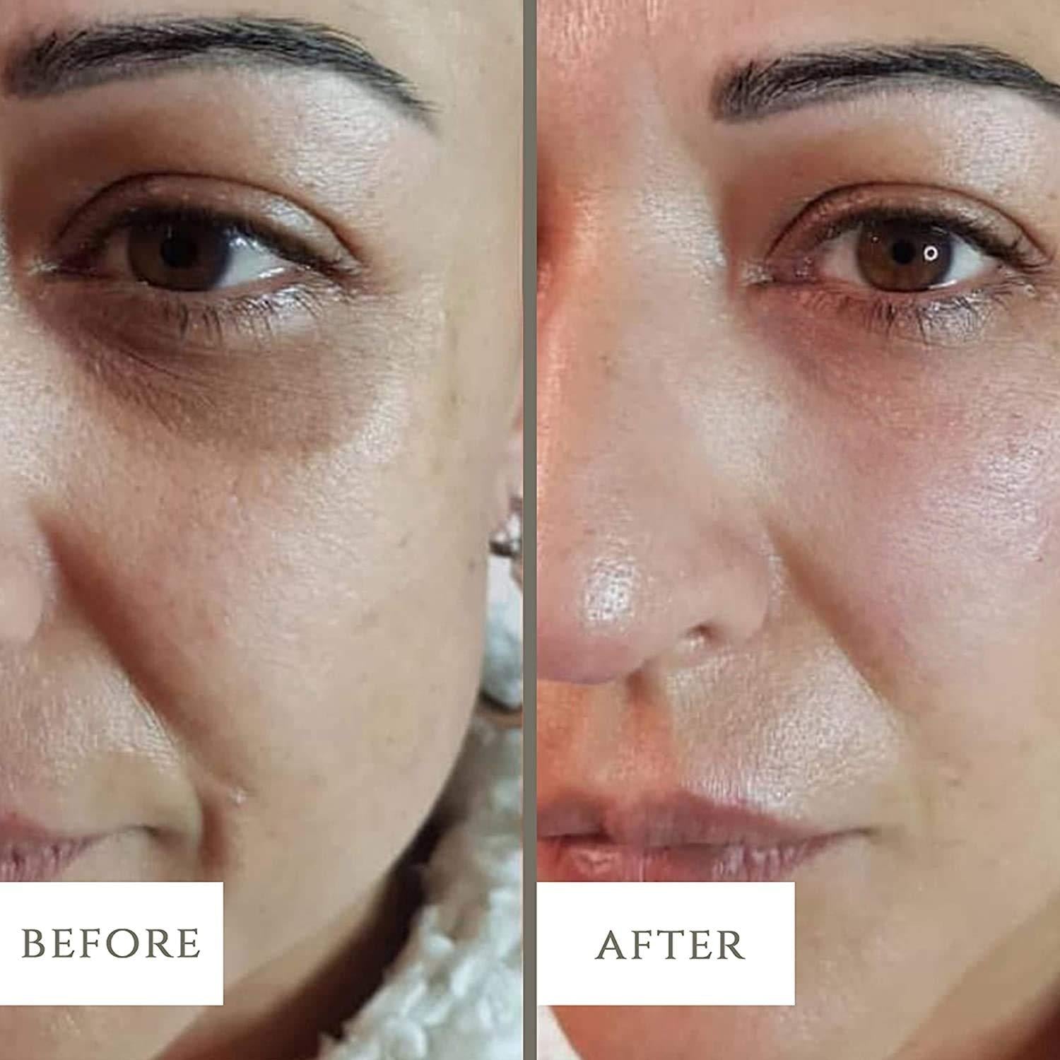 1 RS WHITENING CREAM