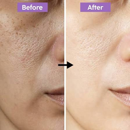 1 RS WHITENING CREAM